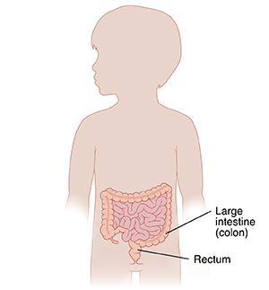 Outline of child showing lower digestive tract.